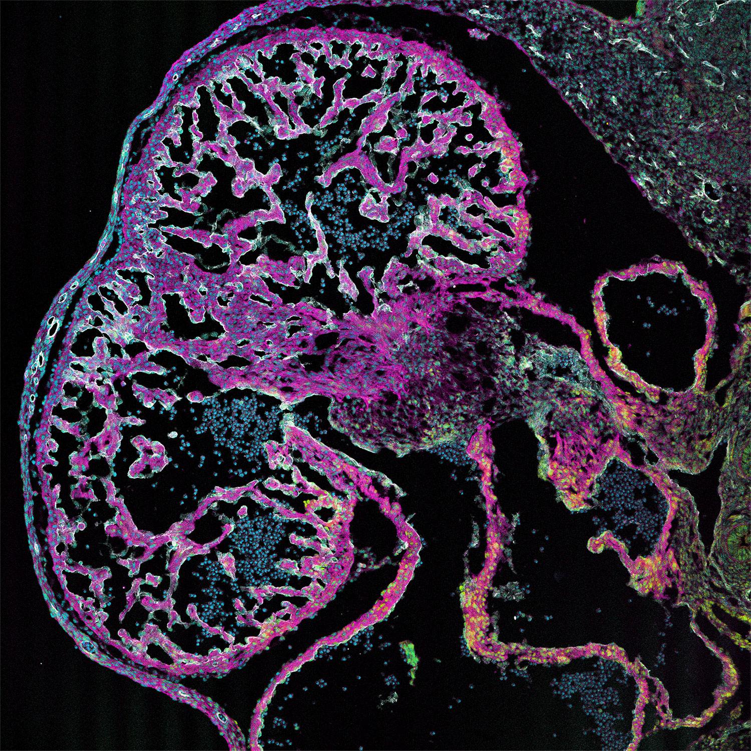 Immunofluorescence (IF) / fluorescent staining of mouse heart tissue using ARL13B Monoclonal antibody (66739-1-Ig)