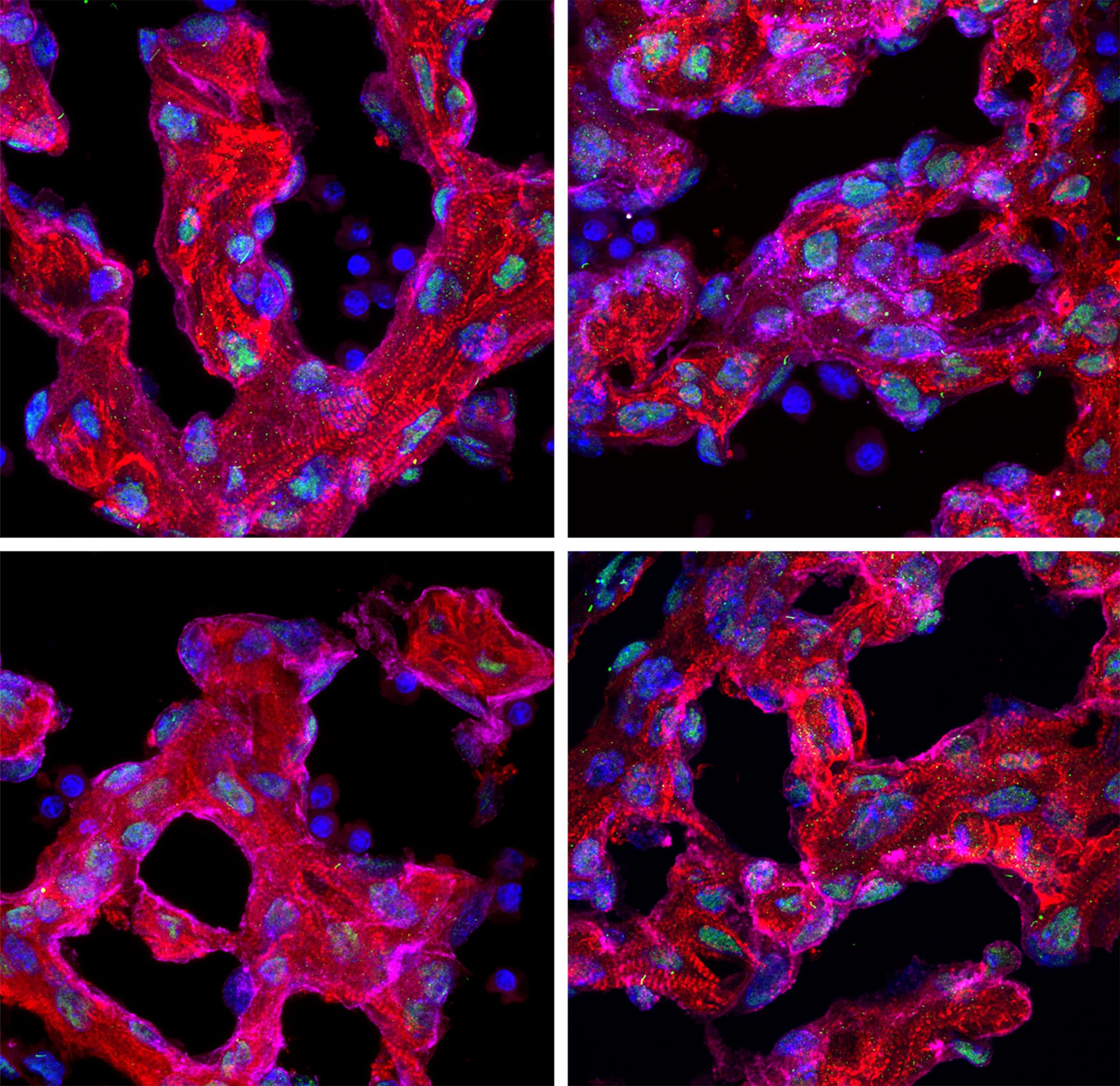 Immunofluorescence (IF) / fluorescent staining of mouse heart tissue using ARL13B Monoclonal antibody (66739-1-Ig)