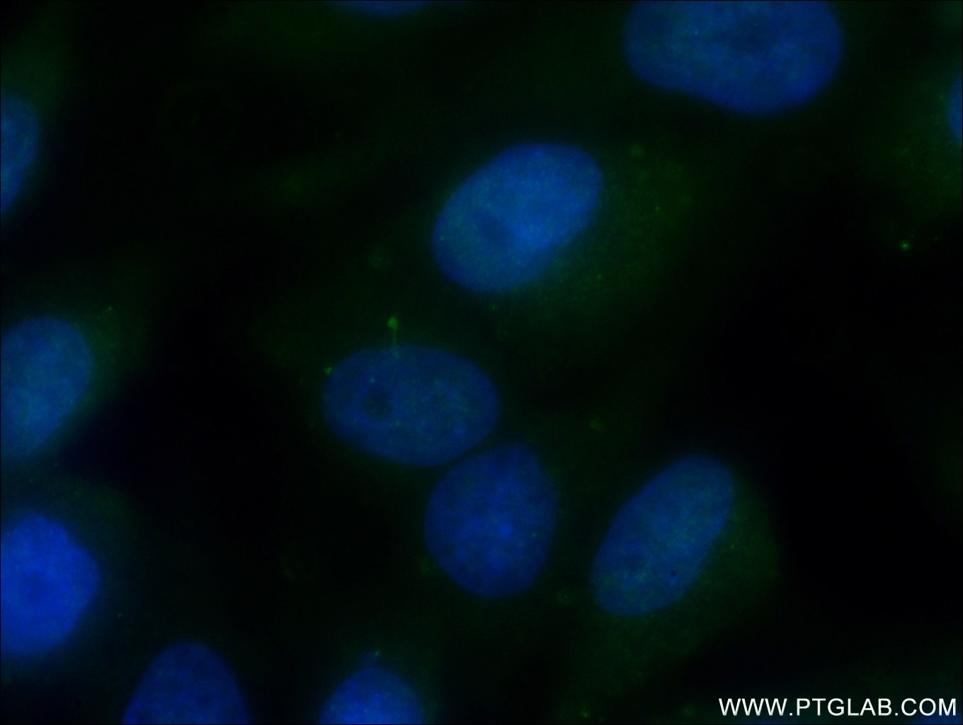 Immunofluorescence (IF) / fluorescent staining of MDCK cells using ARL13B Monoclonal antibody (66739-1-Ig)