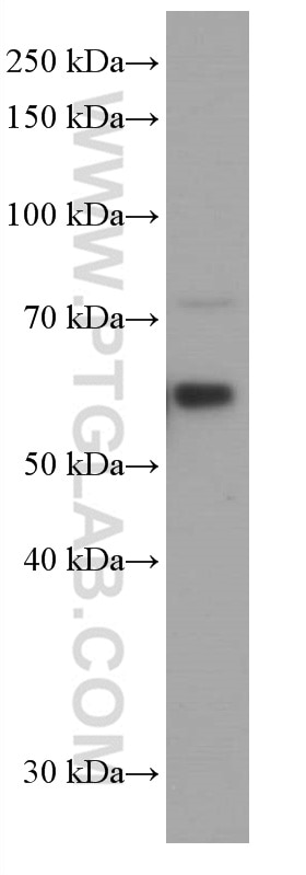 Western Blot (WB) analysis of NCCIT cells using ARL13B Monoclonal antibody (66739-1-Ig)