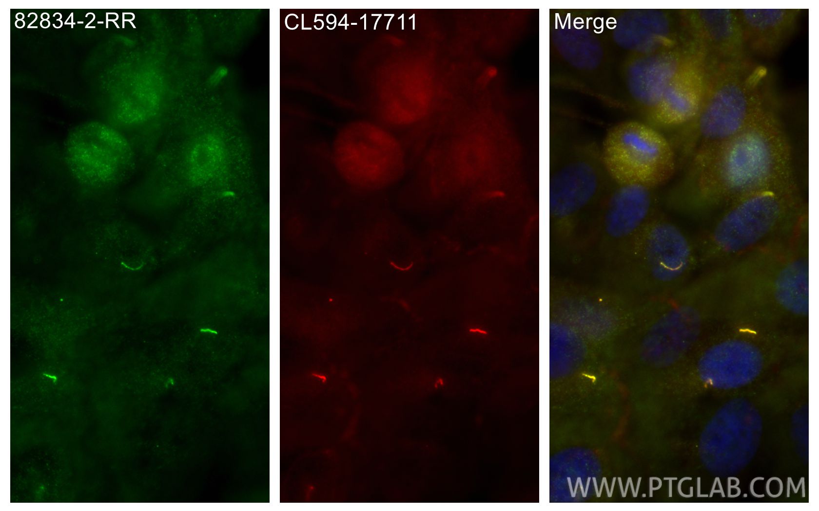 Immunofluorescence (IF) / fluorescent staining of hTERT-RPE1 cells using ARL13B Recombinant monoclonal antibody (82834-2-RR)