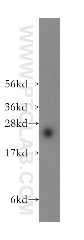 Western Blot (WB) analysis of mouse thymus tissue using ARL15 Polyclonal antibody (11934-1-AP)