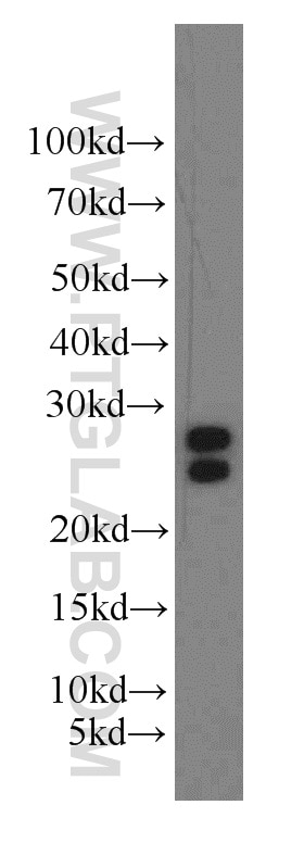 Western Blot (WB) analysis of Y79 cells using ARL2 Polyclonal antibody (10232-1-AP)
