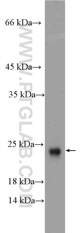 Western Blot (WB) analysis of A549 cells using ARL2BP Polyclonal antibody (10090-2-AP)