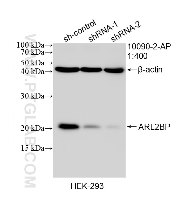 WB result of ARL2BP antibody (10090-2-AP; 1:400; incubated at room temperature for 1.5 hours) with sh-Control and sh-ARL2BP transfected HEK-293 cells. Western Blot (WB) analysis of HEK-293 cells using ARL2BP Polyclonal antibody (10090-2-AP)