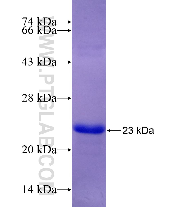 ARL2BP fusion protein Ag29261 SDS-PAGE