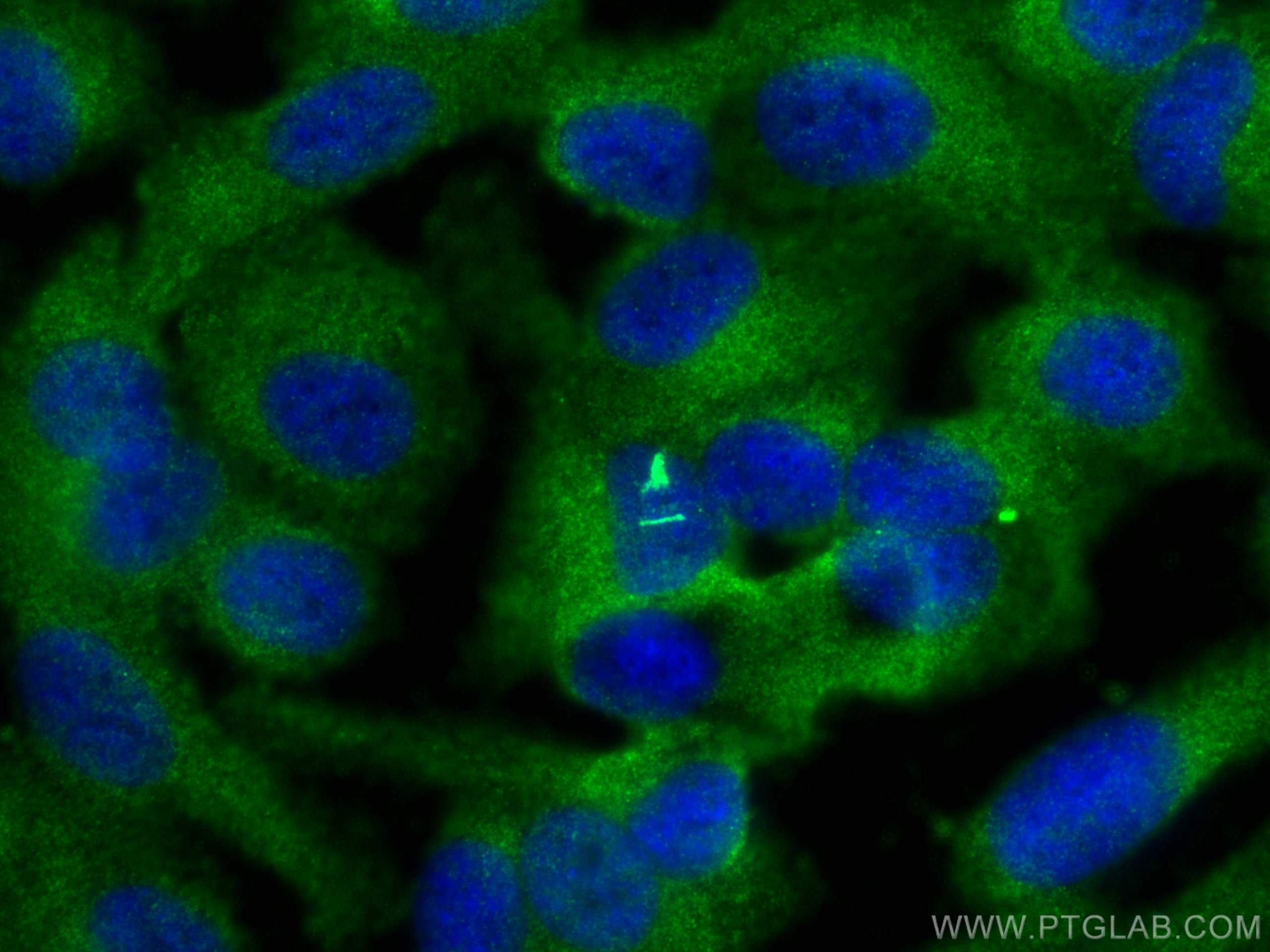 Immunofluorescence (IF) / fluorescent staining of hTERT-RPE1 cells using ARL3 Polyclonal antibody (10961-1-AP)