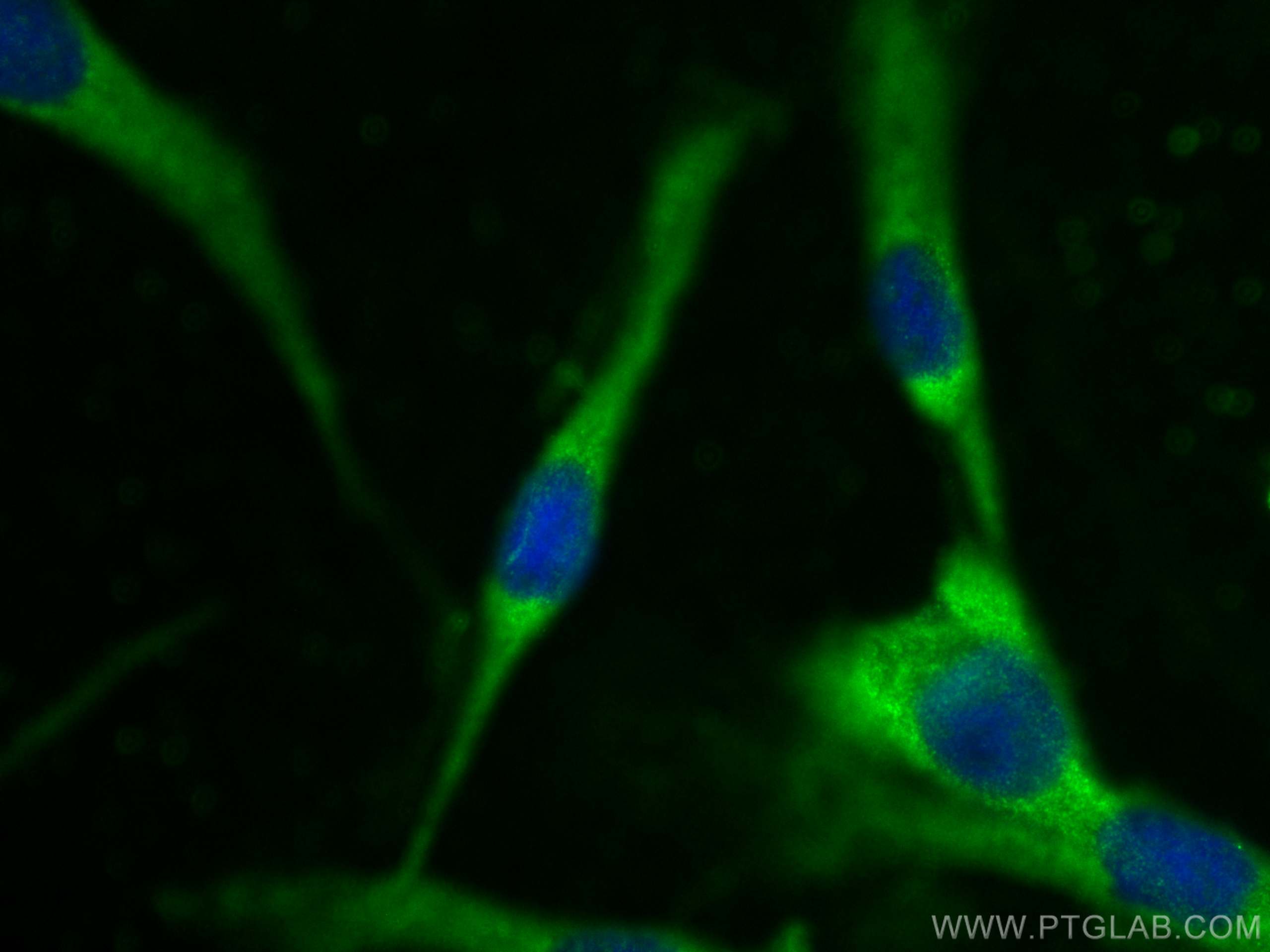 Immunofluorescence (IF) / fluorescent staining of MDCK cells using ARL3 Polyclonal antibody (10961-1-AP)