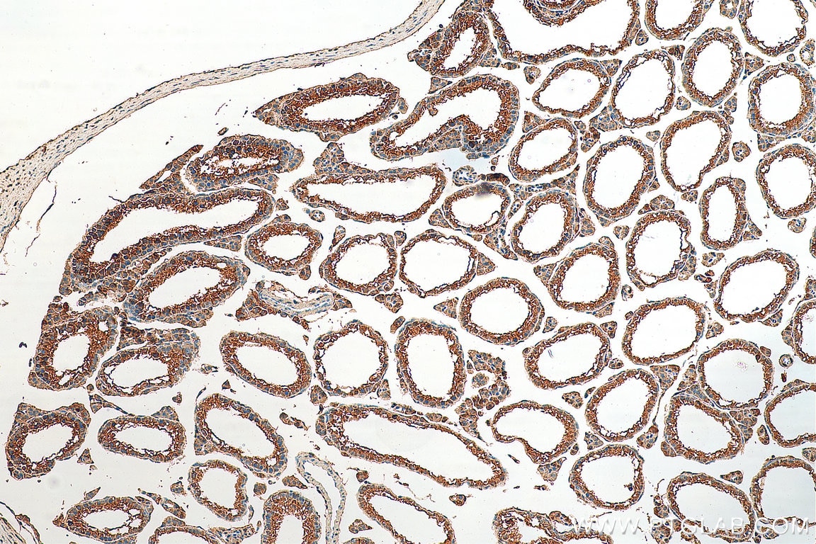 Immunohistochemistry (IHC) staining of mouse testis tissue using ARL3 Polyclonal antibody (10961-1-AP)