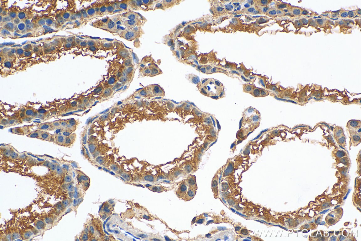 IHC staining of mouse testis using 10961-1-AP