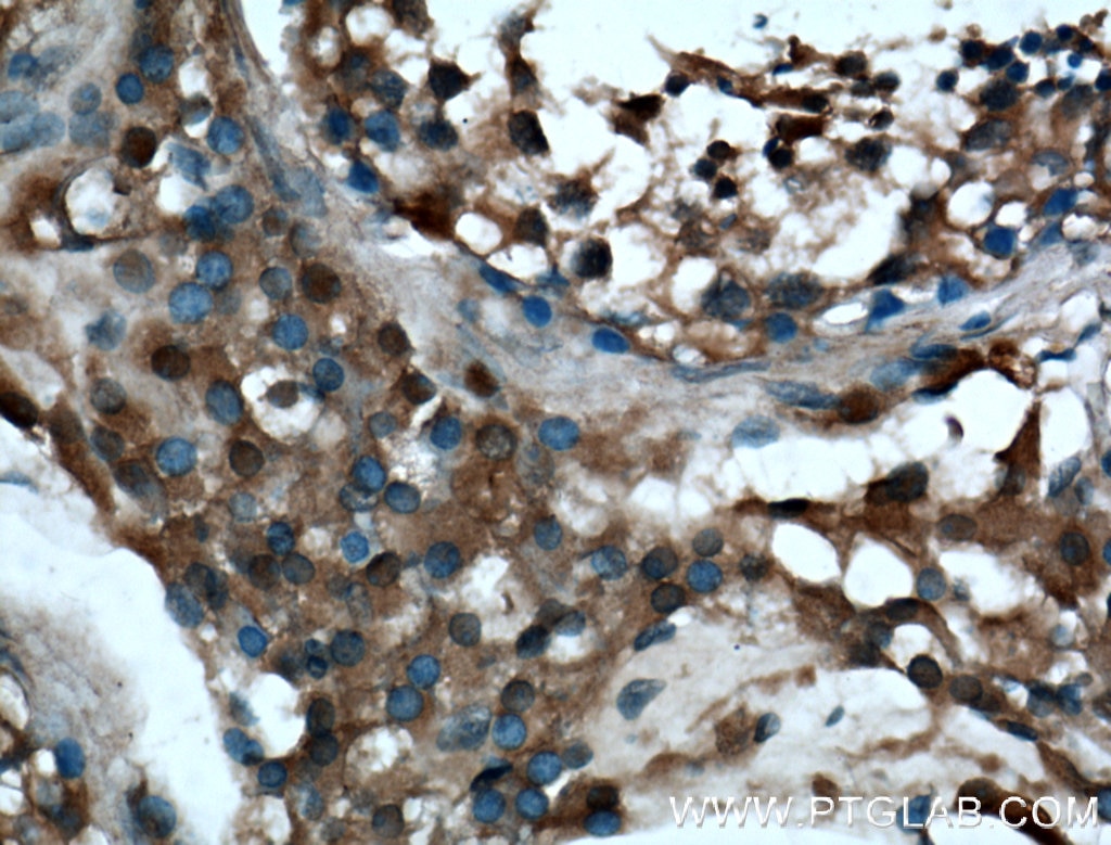 Immunohistochemistry (IHC) staining of human testis tissue using ARL3 Polyclonal antibody (10961-1-AP)