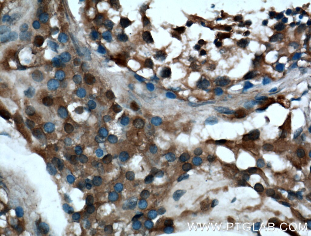 Immunohistochemistry (IHC) staining of human testis tissue using ARL3 Polyclonal antibody (10961-1-AP)