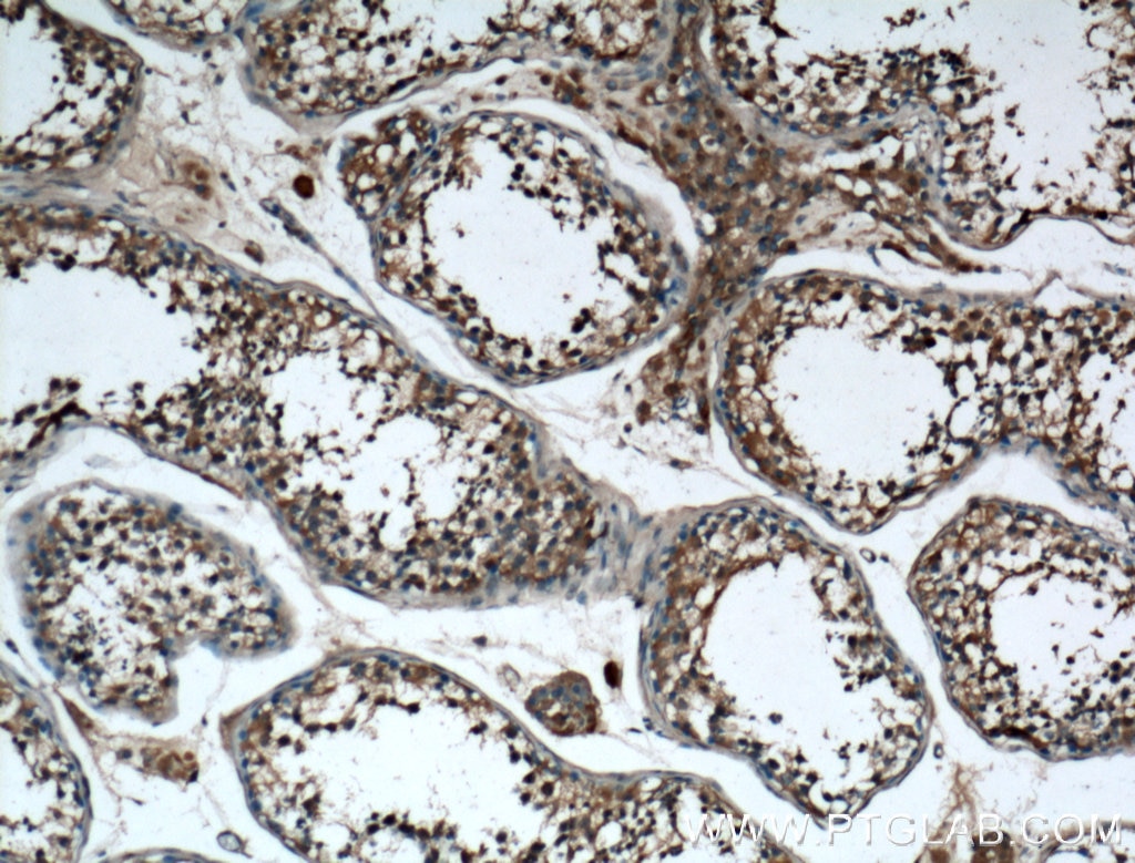 Immunohistochemistry (IHC) staining of human testis tissue using ARL3 Polyclonal antibody (10961-1-AP)