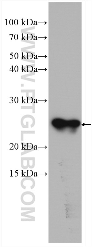 Western Blot (WB) analysis of rat testis tissue using ARL3 Polyclonal antibody (10961-1-AP)