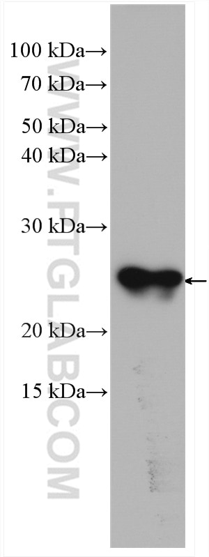 WB analysis of rat testis using 10961-1-AP