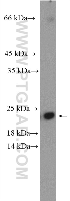 Western Blot (WB) analysis of rat brain tissue using ARL3 Polyclonal antibody (10961-1-AP)