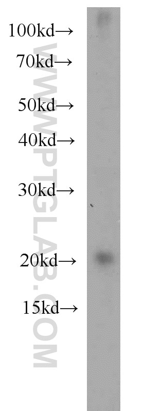 Western Blot (WB) analysis of mouse brain tissue using ARL3 Polyclonal antibody (10961-1-AP)