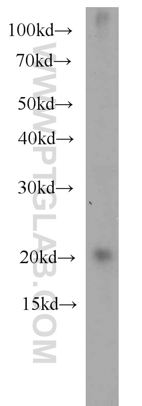 WB analysis of mouse brain using 10961-1-AP