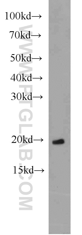 Western Blot (WB) analysis of HeLa cells using ARL3 Polyclonal antibody (10961-1-AP)