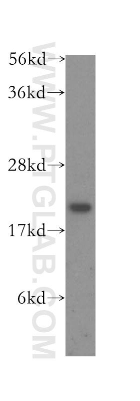 Western Blot (WB) analysis of human brain tissue using ARL3 Polyclonal antibody (10961-1-AP)