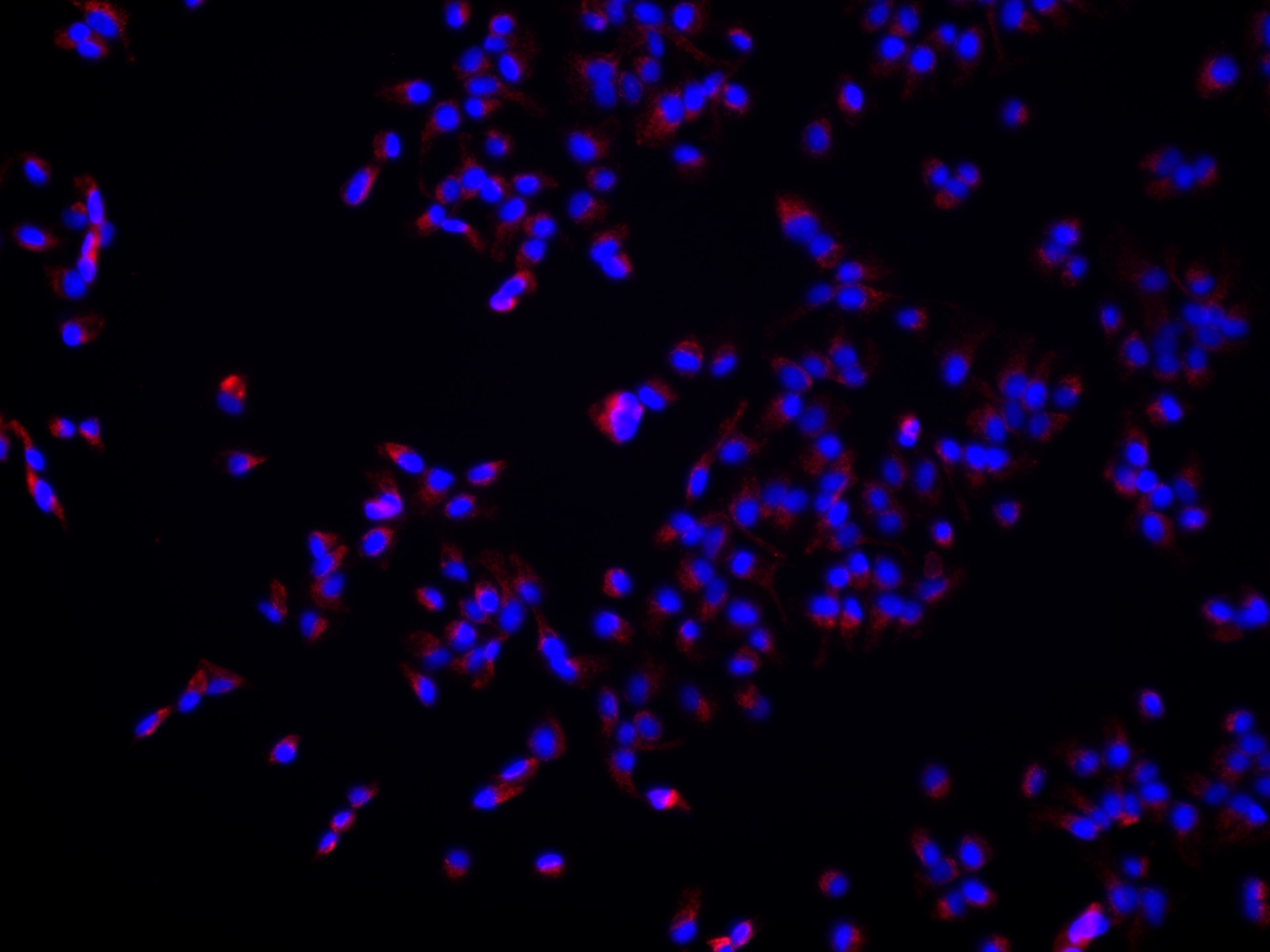 Immunofluorescence (IF) / fluorescent staining of hTERT-RPE1 cells using ARL3 Monoclonal antibody (68421-1-Ig)