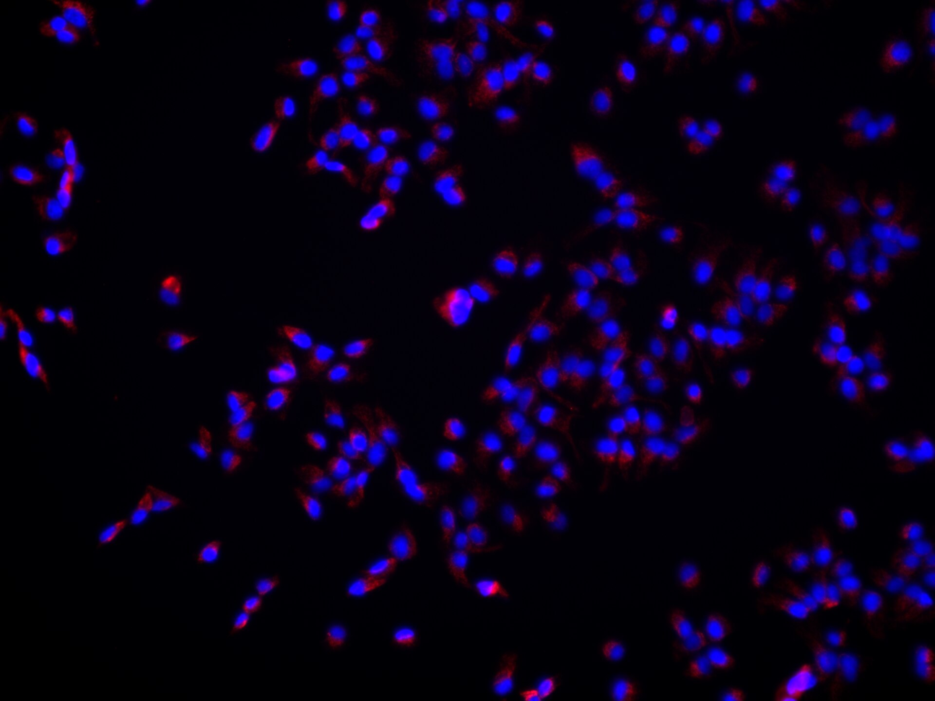 IF Staining of hTERT-RPE1 using 68421-1-Ig