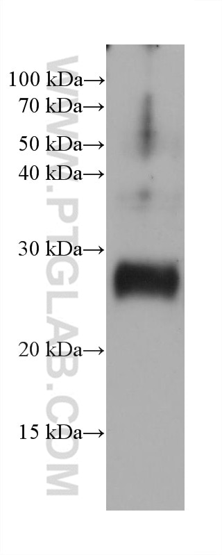 Western Blot (WB) analysis of rabbit testis tissue using ARL3 Monoclonal antibody (68421-1-Ig)