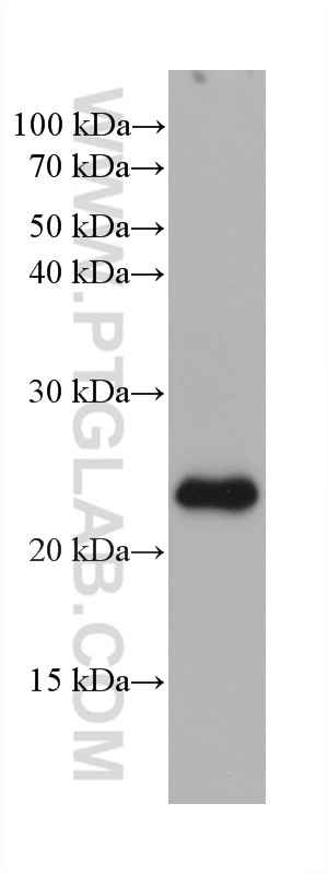 Western Blot (WB) analysis of rat retina tissue using ARL3 Monoclonal antibody (68421-1-Ig)