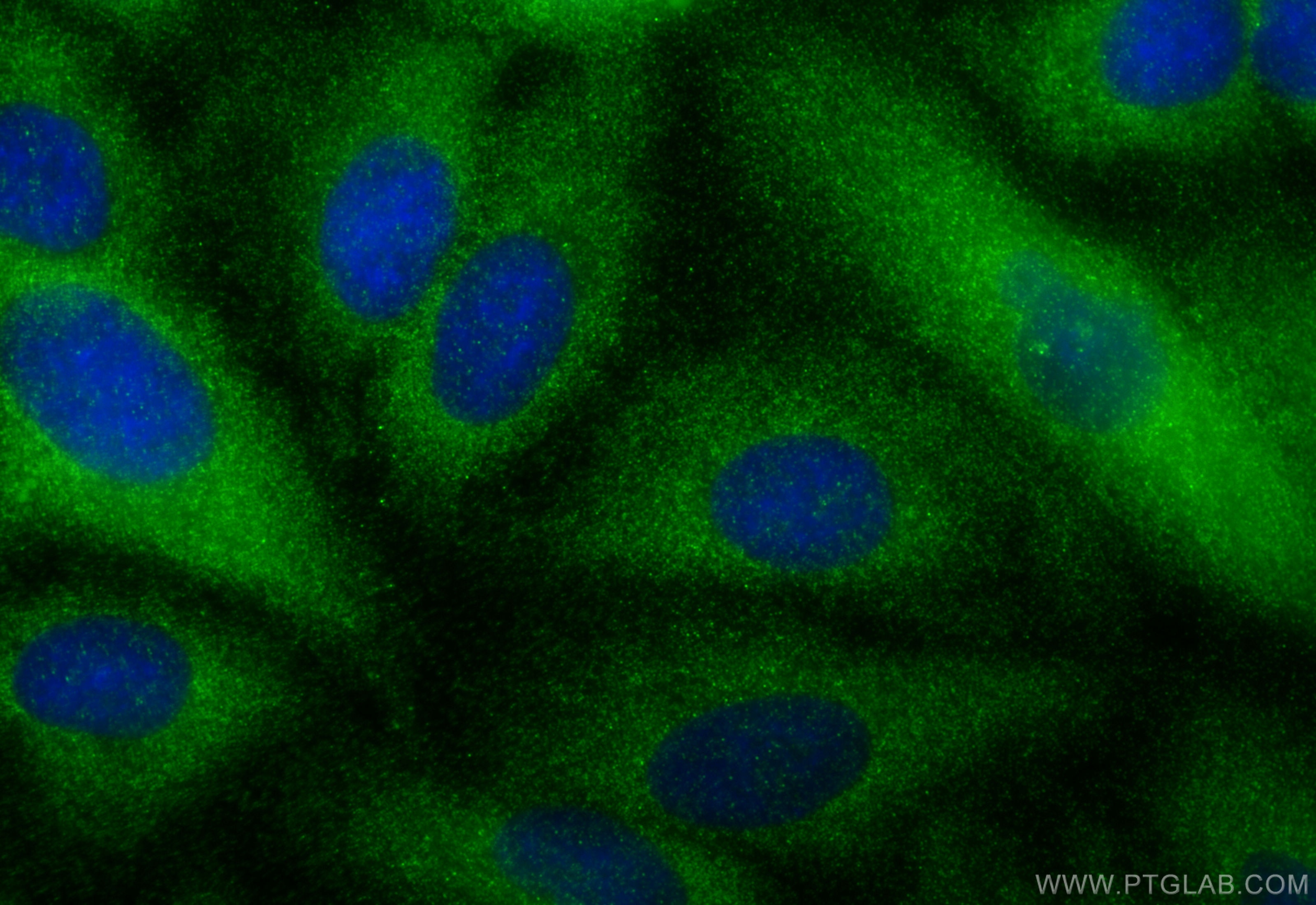 Immunofluorescence (IF) / fluorescent staining of A549 cells using ARL4C Polyclonal antibody (10202-1-AP)