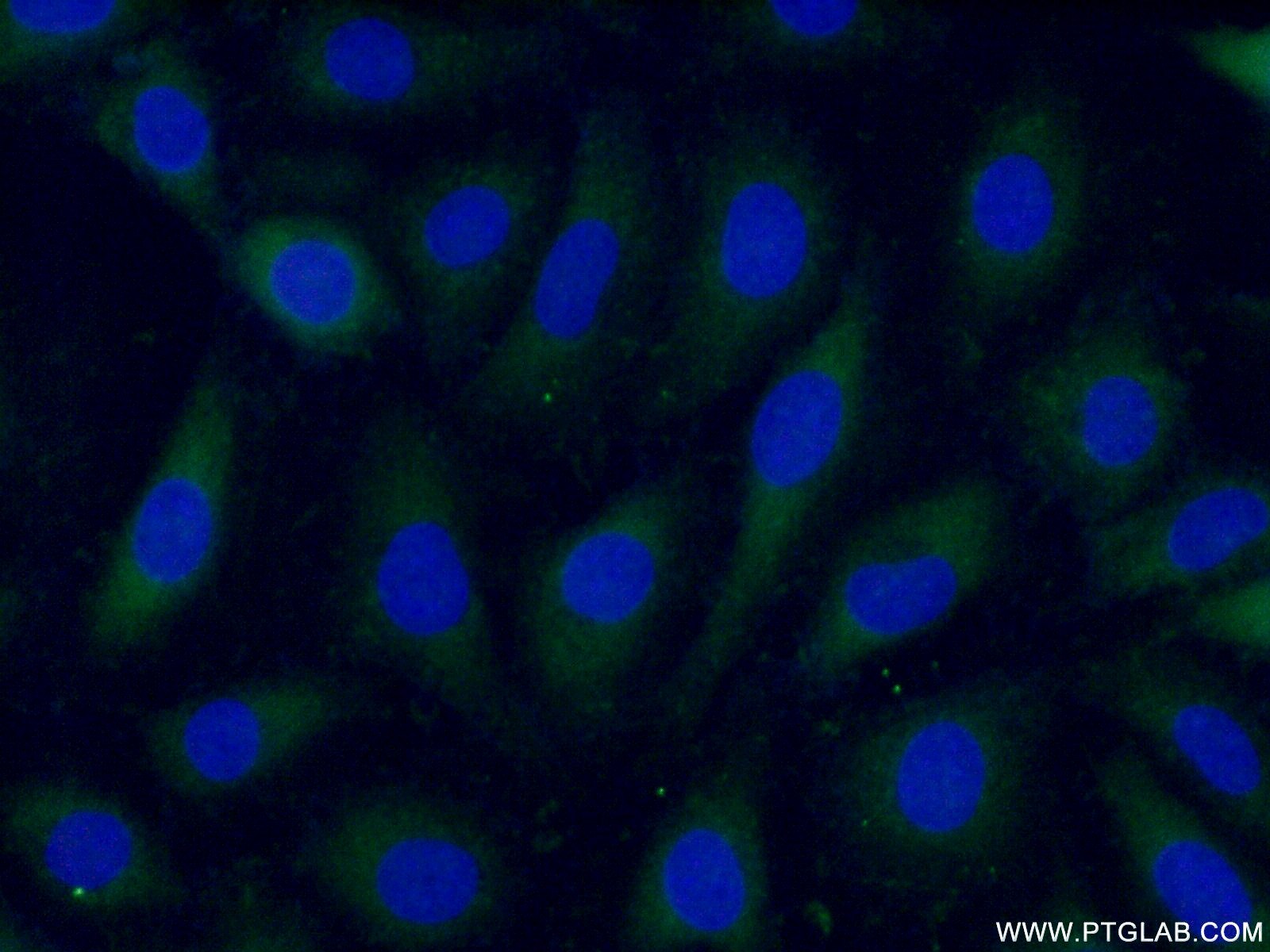 Immunofluorescence (IF) / fluorescent staining of HUVEC cells using ARL4C Polyclonal antibody (10202-1-AP)