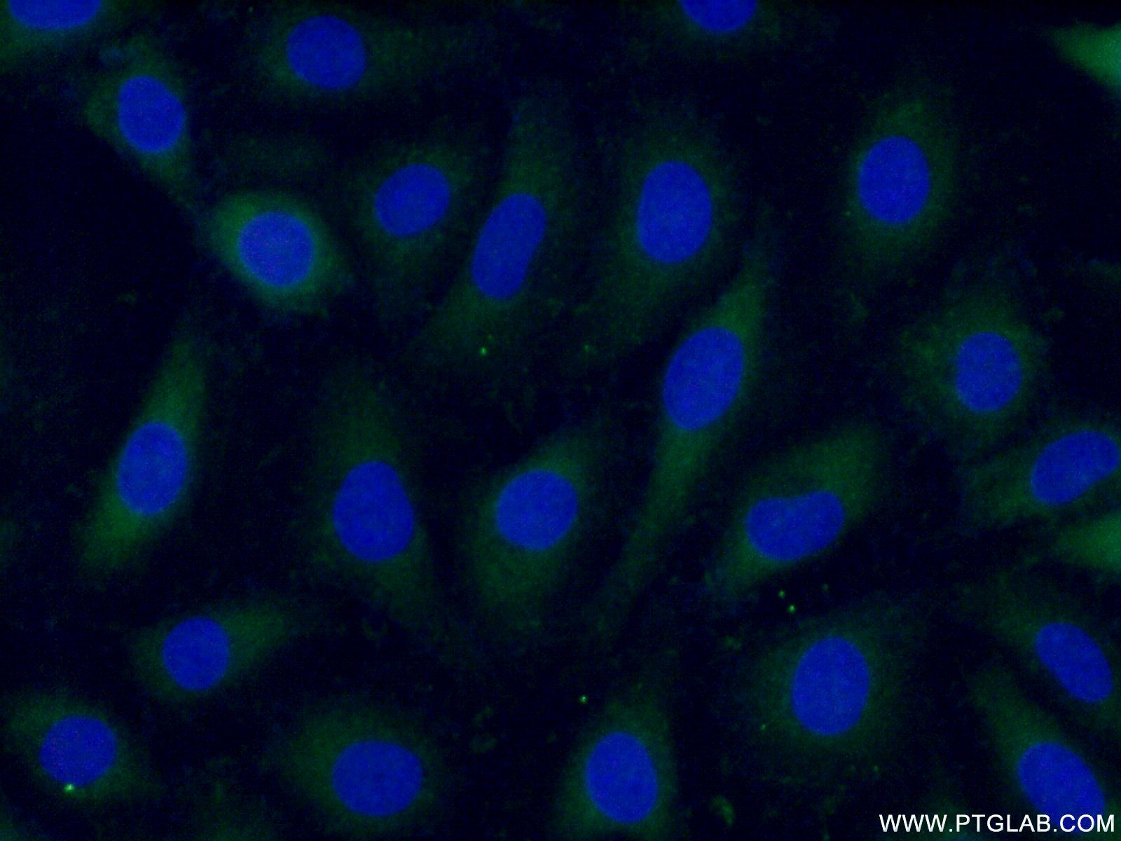 IF Staining of HUVEC using 10202-1-AP