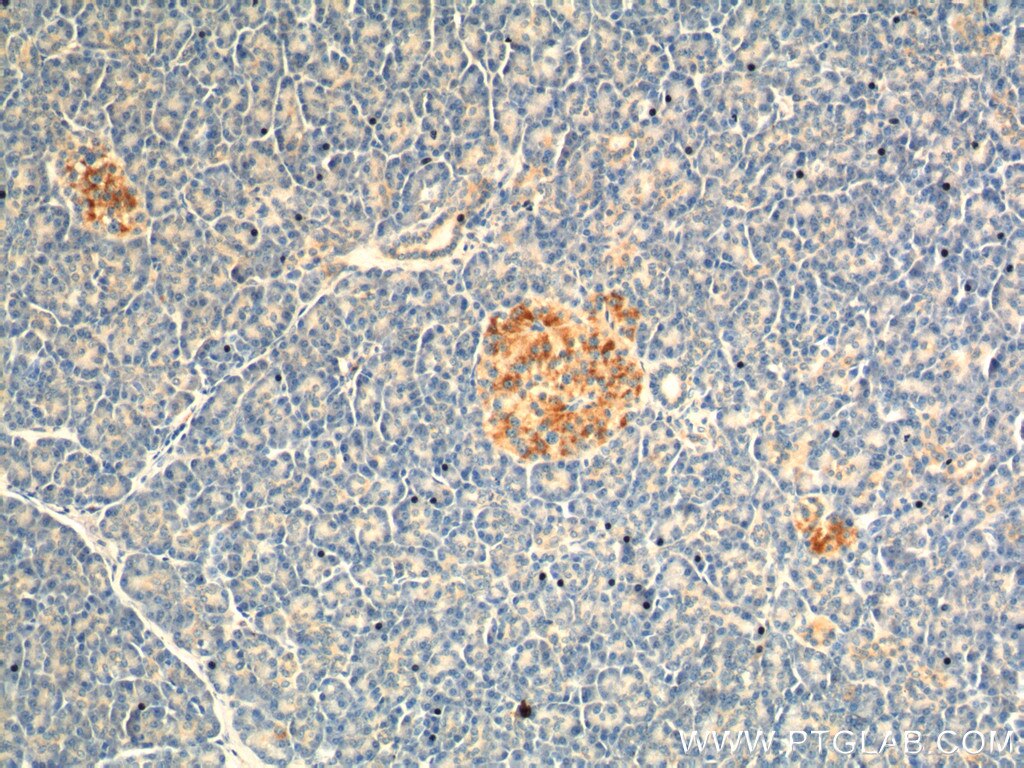 Immunohistochemistry (IHC) staining of human pancreas tissue using ARL4C Polyclonal antibody (10202-1-AP)