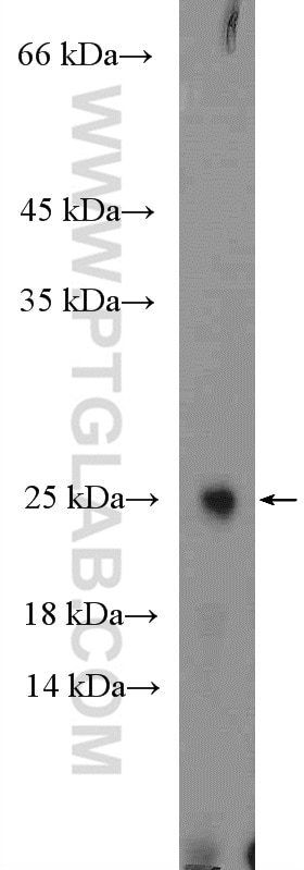 Western Blot (WB) analysis of human brain tissue using ARL4C Polyclonal antibody (10202-1-AP)