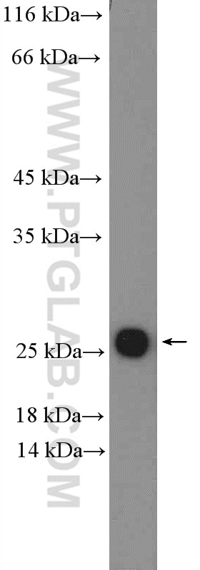 Western Blot (WB) analysis of HUVEC cells using ARL4C Polyclonal antibody (10202-1-AP)