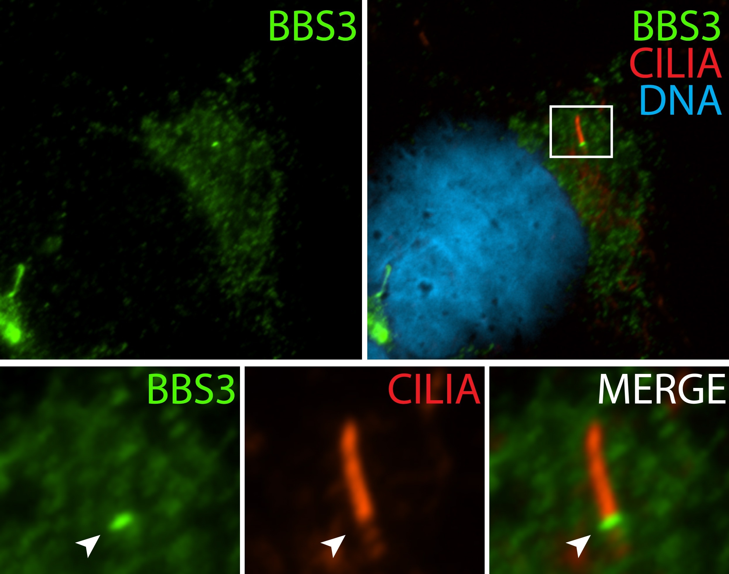 Immunofluorescence (IF) / fluorescent staining of hTERT-RPE1 cells using BBS3 Polyclonal antibody (12676-1-AP)