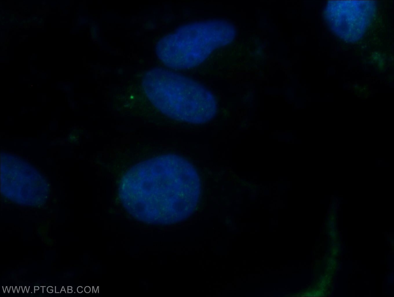 Immunofluorescence (IF) / fluorescent staining of MDCK cells using BBS3 Polyclonal antibody (12676-1-AP)