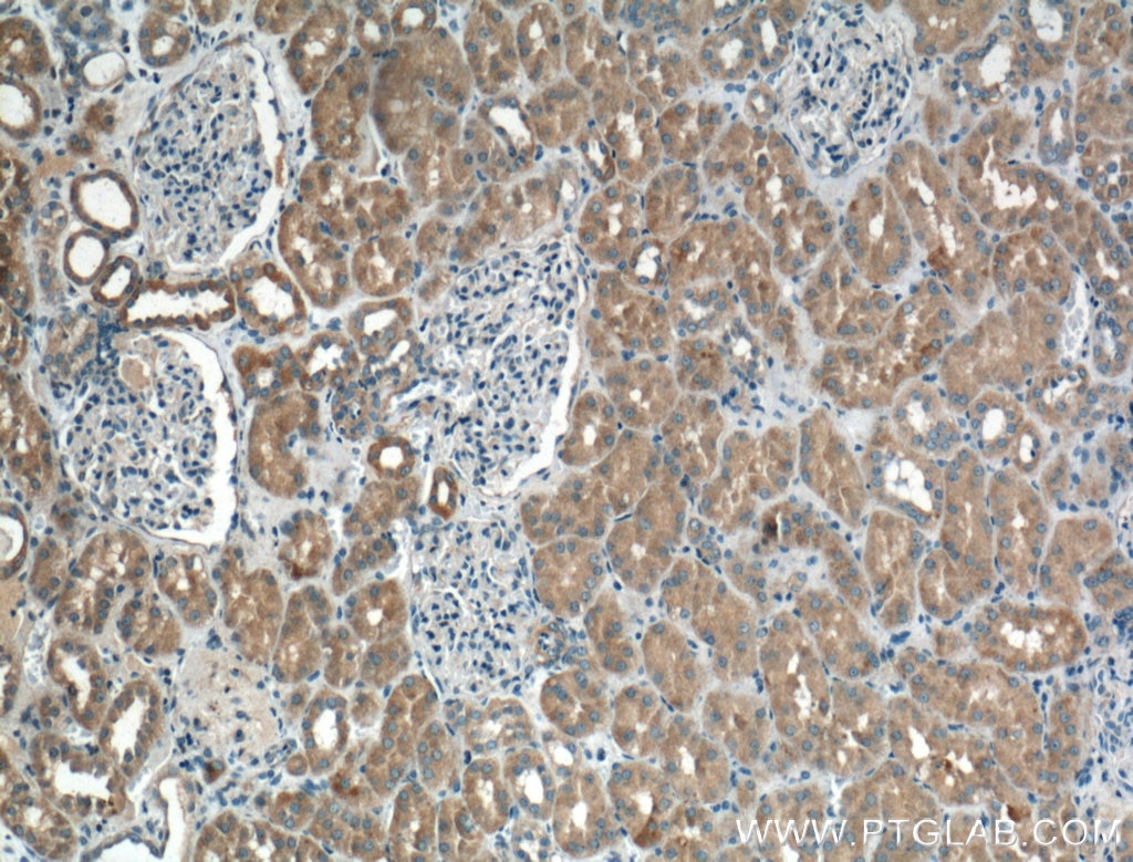 Immunohistochemistry (IHC) staining of human kidney tissue using BBS3 Polyclonal antibody (12676-1-AP)