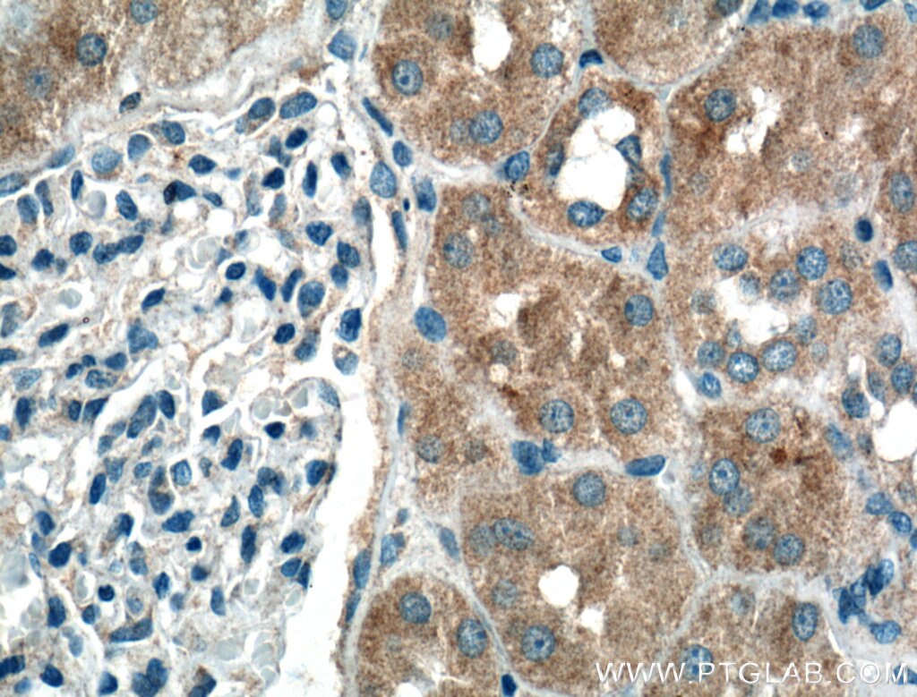 Immunohistochemistry (IHC) staining of human kidney tissue using BBS3 Polyclonal antibody (12676-1-AP)