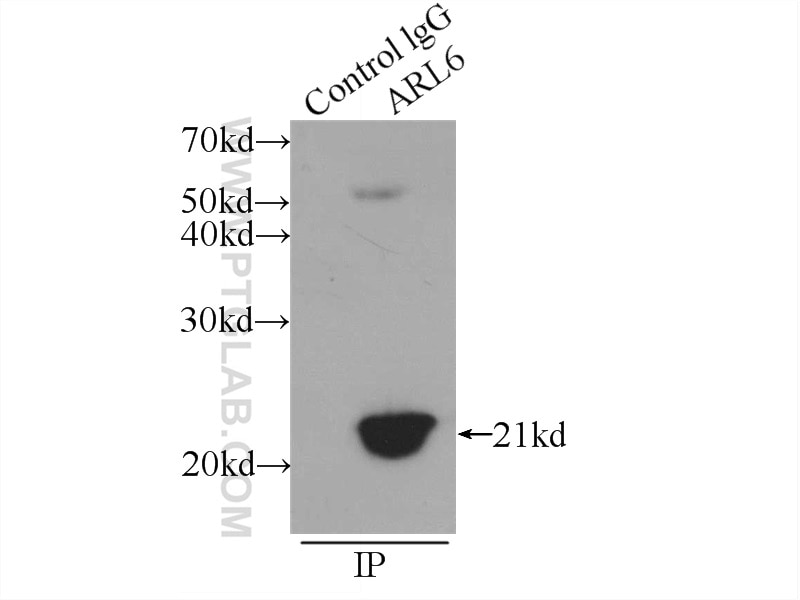 Immunoprecipitation (IP) experiment of rat brain tissue using BBS3 Polyclonal antibody (12676-1-AP)