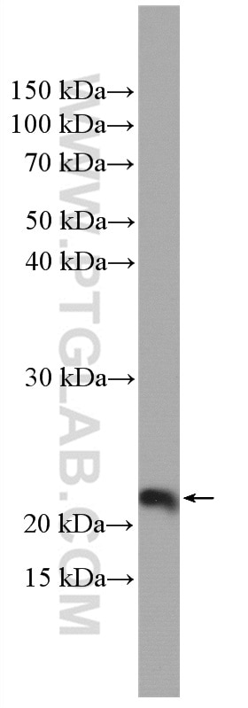 Western Blot (WB) analysis of HEK-293T cells using BBS3 Polyclonal antibody (12676-1-AP)