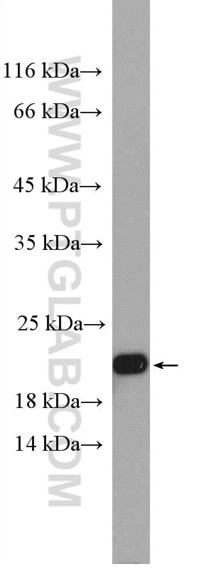 Western Blot (WB) analysis of mouse brain tissue using BBS3 Polyclonal antibody (12676-1-AP)