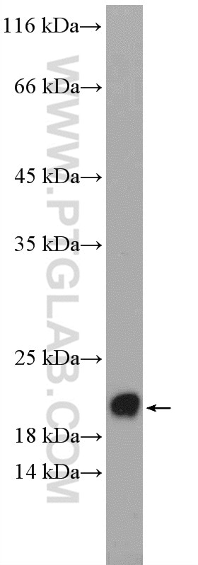 Western Blot (WB) analysis of rat brain tissue using BBS3 Polyclonal antibody (12676-1-AP)