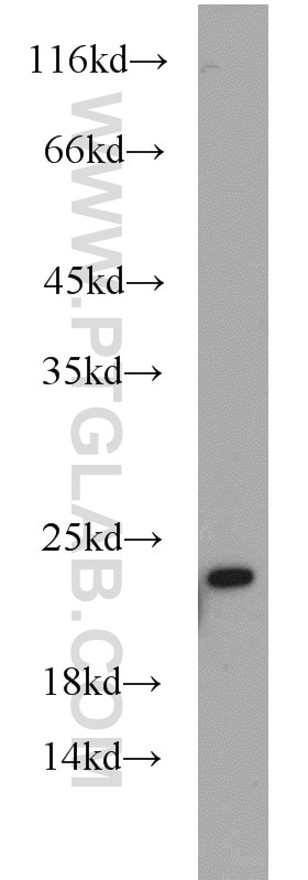 Western Blot (WB) analysis of human brain tissue using BBS3 Polyclonal antibody (12676-1-AP)