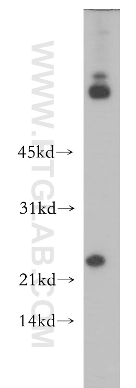 Western Blot (WB) analysis of K-562 cells using ARMER Polyclonal antibody (12988-1-AP)