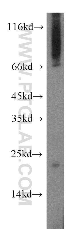 WB analysis of mouse lung using 12988-1-AP