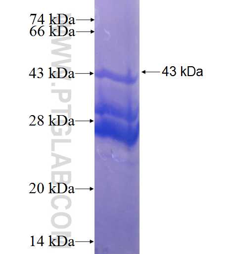 ARL6IP4 fusion protein Ag0863 SDS-PAGE
