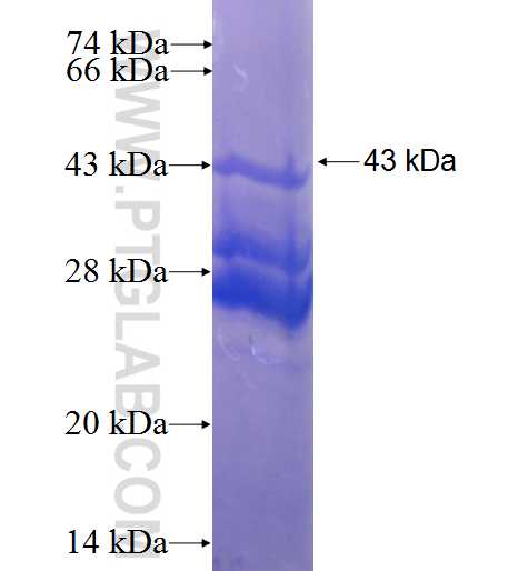 ARL6IP4 fusion protein Ag0863 SDS-PAGE