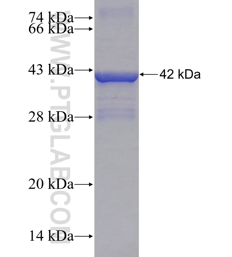 ARL6IP5 fusion protein Ag2470 SDS-PAGE