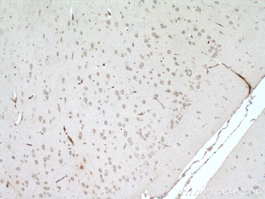 Immunohistochemistry (IHC) staining of mouse brain tissue using ARL6IP6 Polyclonal antibody (16956-1-AP)