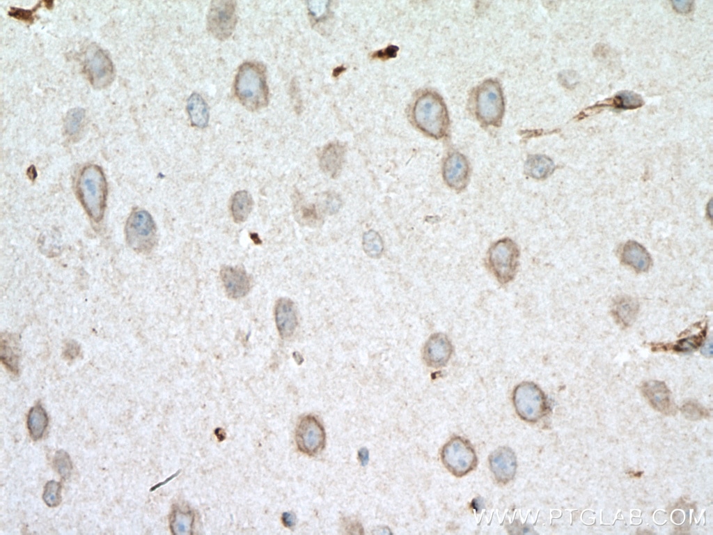 Immunohistochemistry (IHC) staining of mouse brain tissue using ARL6IP6 Polyclonal antibody (16956-1-AP)